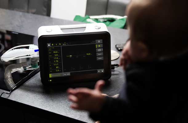 Löwenstein LUISA solunum ventilatör ve HFT tedavi cihazı